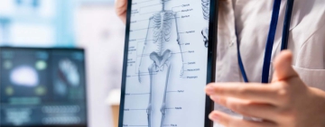 КОЦ - Пловдив стартира априлска кампания за изследване на костна плътност на намалени цени